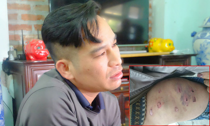 Vụ bố ruột dùng dây điện đánh đập con trai 9 tuổi dã man: “Do tôi hơi nóng tính nên đã đánh con”