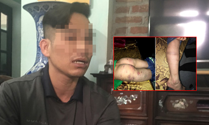 Bố đánh con trai 9 tuổi chi chít sẹo: “Tôi không lấy vợ 2 vì còn con cái”