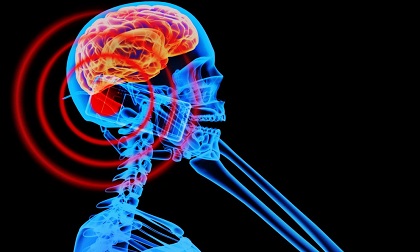 7 vị trí tuyệt đối không được để điện thoại tránh u não, ung thư