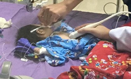 Bé trai 45 ngày tuổi suýt chết vì ho kéo dài không được điều trị