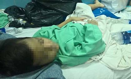 Bé trai bị mẹ đẻ, bố dượng đánh gãy xương đùi