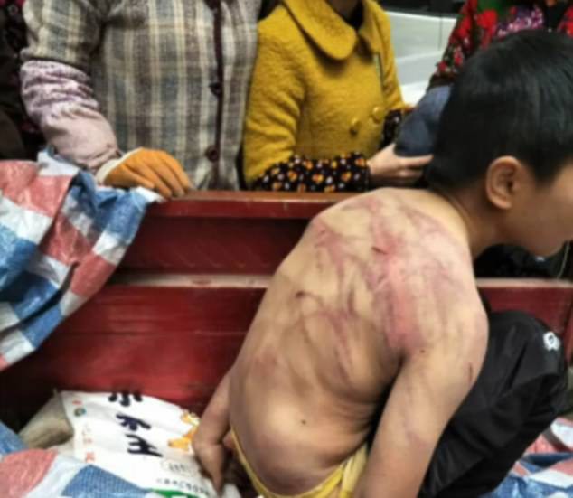 Bị bố mẹ đánh đập dã man, cậu bé mình chi chít vết roi, cởi trần vạ vật giữa trời âm độ - Ảnh 2. Bị bố mẹ đánh đập dã man, cậu bé mình chi chít vết roi, cởi trần vạ vật giữa trời âm độ - Ảnh 2.
