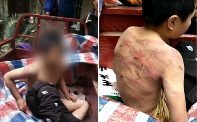 Bị bố mẹ đánh đập dã man, cậu bé mình chi chít vết roi, cởi trần vạ vật giữa trời âm độ - Ảnh 1. Bị bố mẹ đánh đập dã man, cậu bé mình chi chít vết roi, cởi trần vạ vật giữa trời âm độ - Ảnh 1.