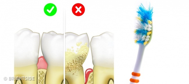 Tự rước bệnh với những sai lầm kinh điển khi vệ sinh cá nhân - 2