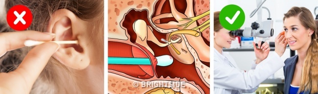 Tự rước bệnh với những sai lầm kinh điển khi vệ sinh cá nhân - 1