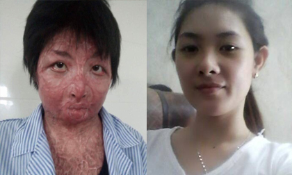 Cuộc sống tươi mới của người phụ nữ xinh đẹp bị chồng tẩm xăng đốt