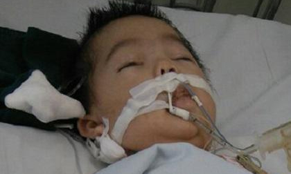 Vụ bé 8 tháng bị điều dưỡng tiêm nhầm thuốc: Cháu bé đang có dấu hiệu chết não