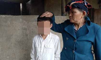 Sơn La:Trẻ 12 tuổi bị đánh đòn bầm dập vì nghi trộm 500 nghìn đồng
