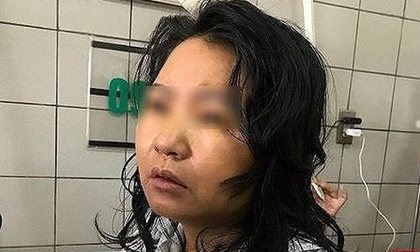 Nữ y tá bị hôn mê nghi do thực phẩm chức năng giảm cân đã qua đời