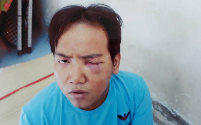 Hoàng Nhất Giang theo kết quả giám định pháp y bị tâm thần phân liệt thể hoang tưởng.