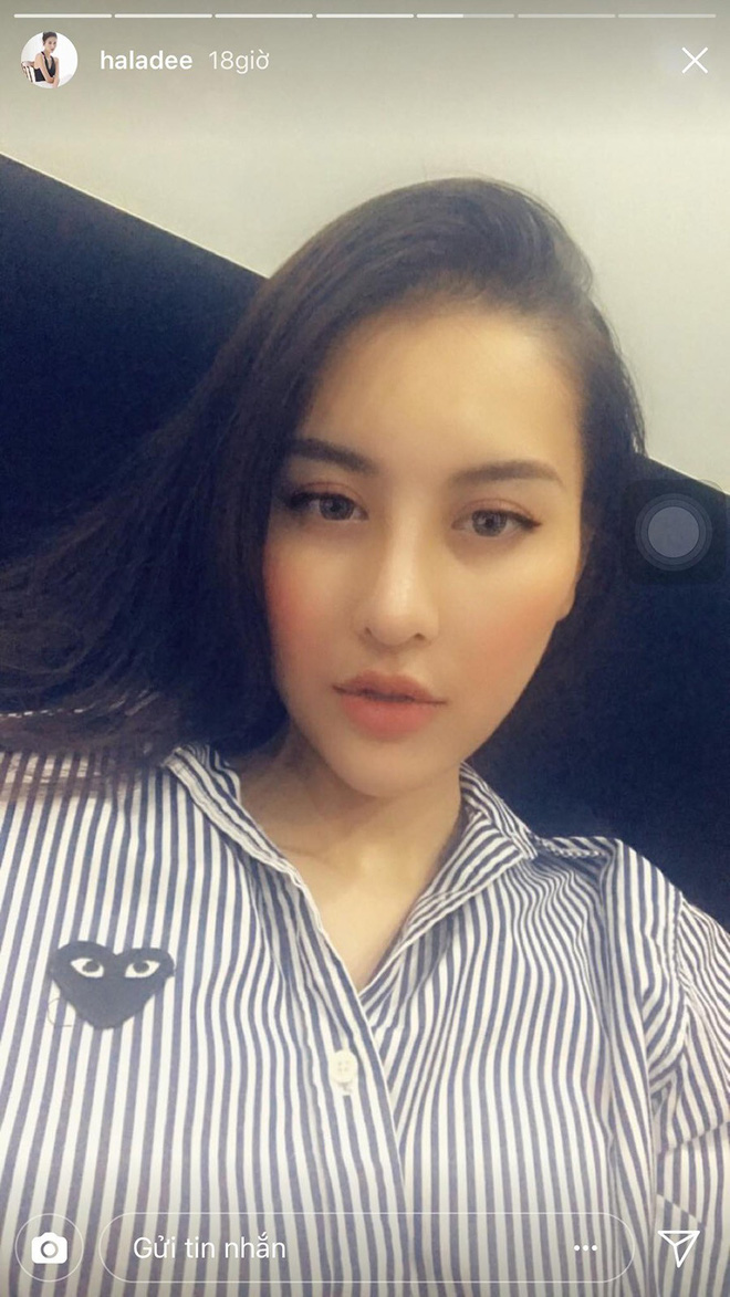 Gương mặt của Hà Lade ngày càng nhọn và dài giống hệt trào lưu thẩm mỹ mặt rắn-6