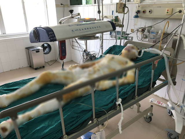 Tai họa bất ngờ khiến sự sống của cô gái trẻ đang vô cùng nguy kịch. Ảnh: NT