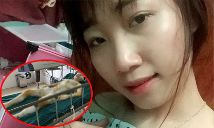 Xót xa cô gái xinh đẹp bị thiêu xăng khi đang nằm ngủ: “Khả năng qua khỏi mong manh lắm!”