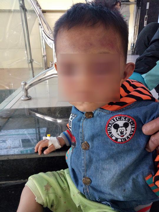 tam giu bo duong danh con rieng 2 tuoi cua vo den muc phai nhap vien - 1