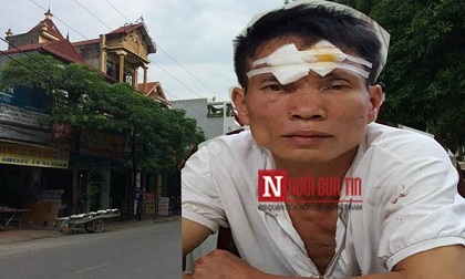 Công an tiết lộ nguyên nhân khiến chú chém “cả họ” trước giờ cháu đón dâu