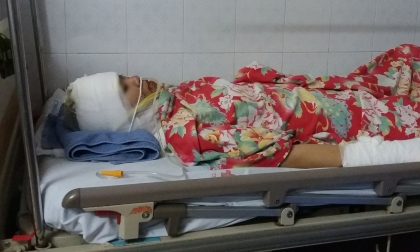 Người vợ bị chồng cũ tạt axit bỏng toàn thân: ‘Con không muốn anh ấy bị đi tù’