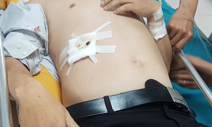 Bị nhắc nhở hình xăm trên cổ, học trò đâm thầy giáo thấu bụng