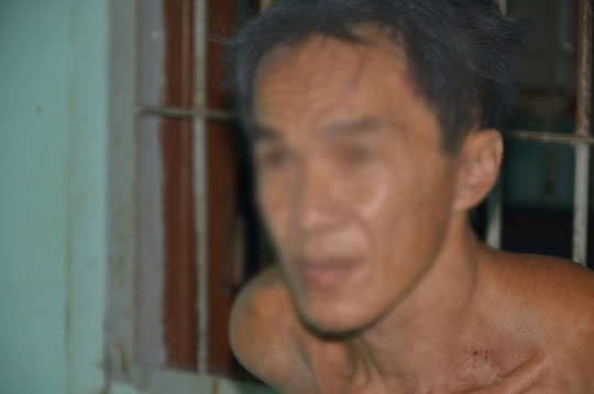 ke chat dau hang xom, chem lia tay cong an doi dien hinh phat nao? hinh anh 1