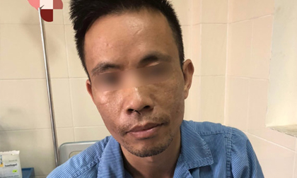 Thường xuyên đau đầu, cần lưu ý đến bệnh chết người này