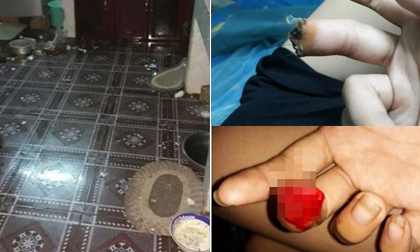 Cha nhẫn tâm cắn đứt lóng tay con gái 18 tuổi, người mẹ chỉ biết im lặng cho qua vì sợ cả nhà bị giết