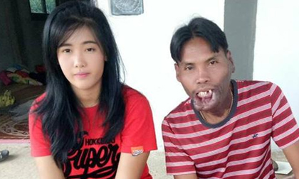 Bất chấp xã hội gièm pha về ngoại hình, cặp đôi 'đũa lệch' vẫn sống vô cùng hạnh phúc
