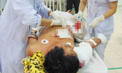 Bất đồng quan điểm khi... nhậu, cháu chém chú 10 nhát dao