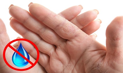 Chỉ cần vài giây để biết dấu hiệu trên bàn tay báo trước bệnh nan y