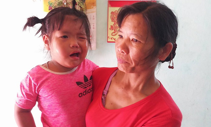 Thanh Hóa: Cô giáo đánh vào đầu khiến bé 3 tuổi méo miệng?
