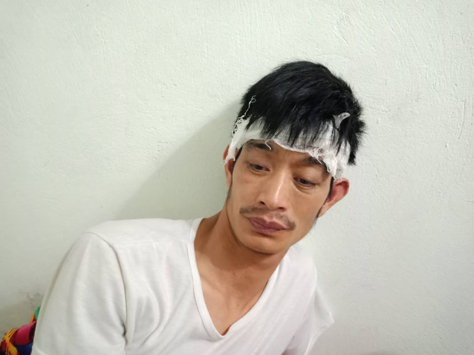 Bị đánh khiến anh Điềm vẫn choáng váng.