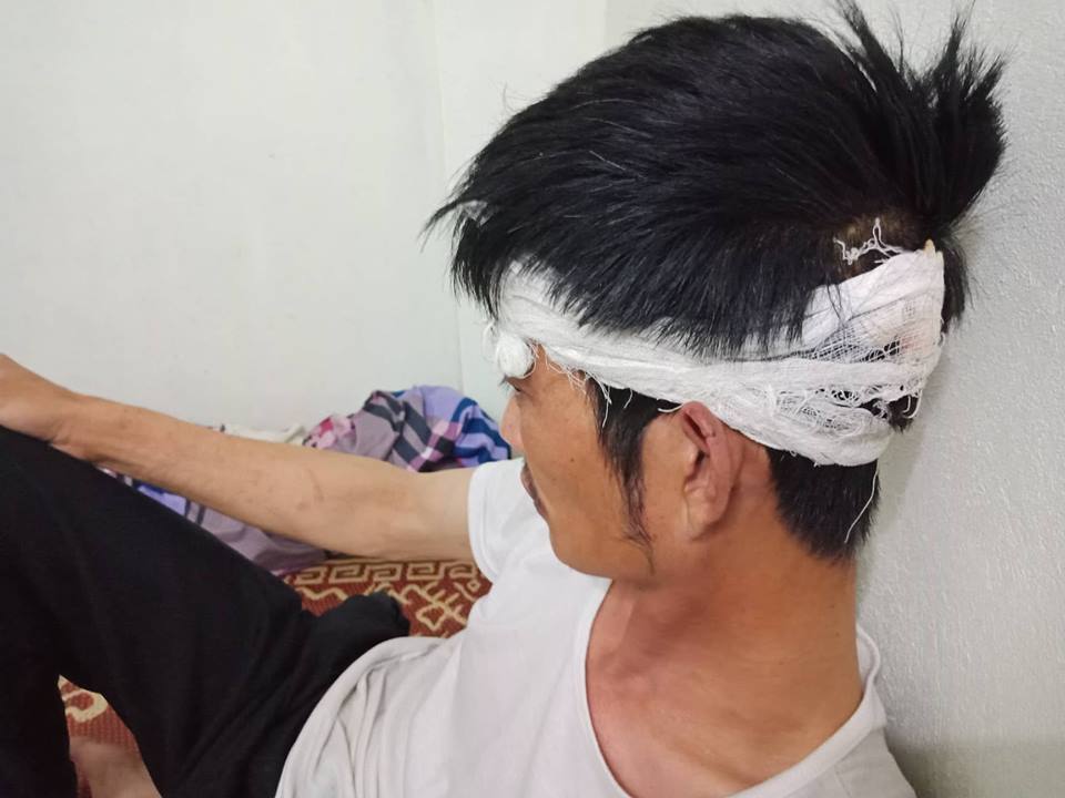 Anh Điềm cho biết mong muốn cơ quan chức năng xử lý việc người đàn ông đã hành hung mình.