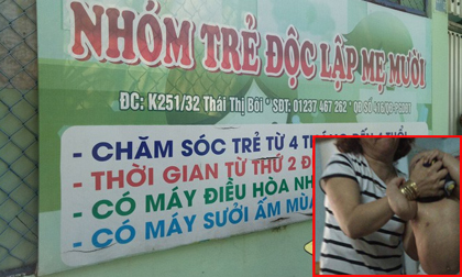 Bảo mẫu vừa bóp đầu vừa tát trẻ mầm non dã man ở Đà Nẵng: Có thể xử phạt mức án 3 năm tù