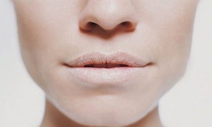 Nhìn sắc môi có thể đoán được tình trạng sức khỏe của bạn