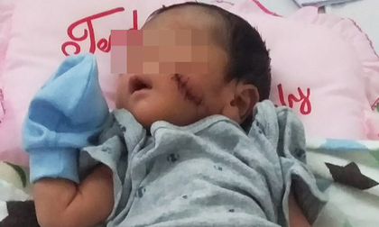 Bé trai bị chôn sống ở Bình Thuận sức khỏe đã ổn định, vẫn chưa có người thân đến nhận