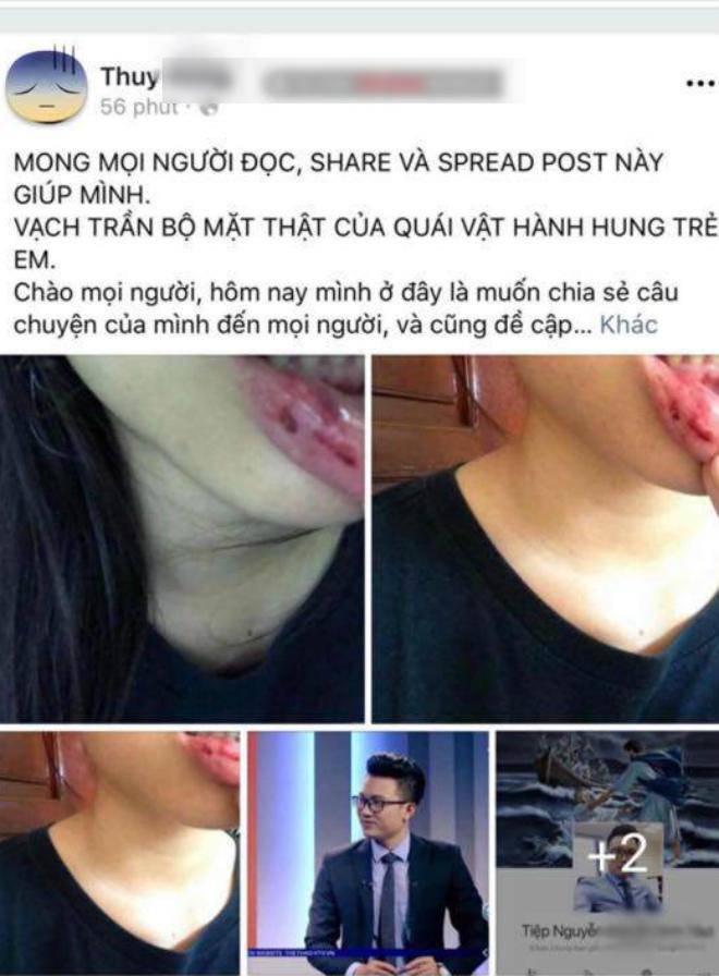 vu btv minh tiep bi to bao hanh: bo thuy d. xac nhan con re co bat tai con gai - 1