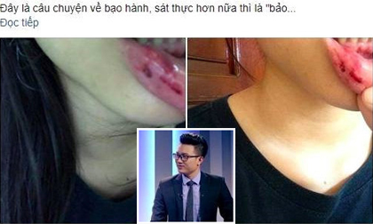 Nếu việc bị tố bạo hành em vợ đúng sự thật, MC của VTV đối mặt hình phạt nào?