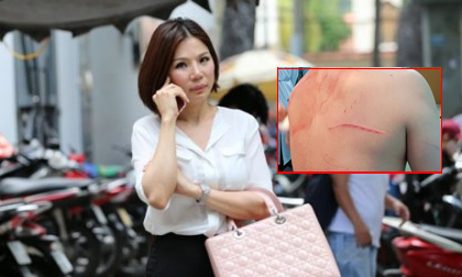 Bác sĩ Chiêm Quốc Thái: 'Tôi nghi ngờ người chủ mưu vụ truy sát mình giữa phố không phải là vợ cũ'