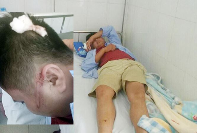Để con trớ trên ô tô khách, hai người bị truy sát dã man - 1