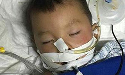 Bé trai đột tử vì mẹ đánh vào đầu: 5 bộ phận cơ thể cha mẹ tránh gây tổn thương