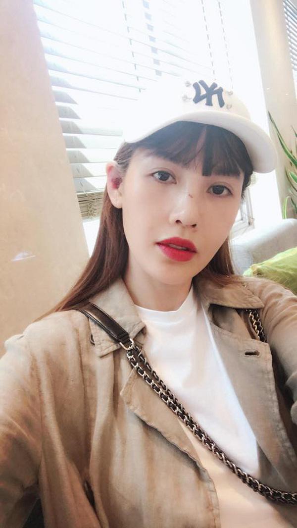 dien mao que van sau 6 lan phau thuat tham my gio ra sao? - 2