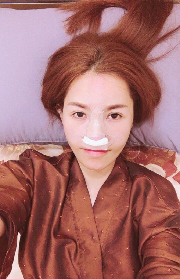 dien mao que van sau 6 lan phau thuat tham my gio ra sao? - 3