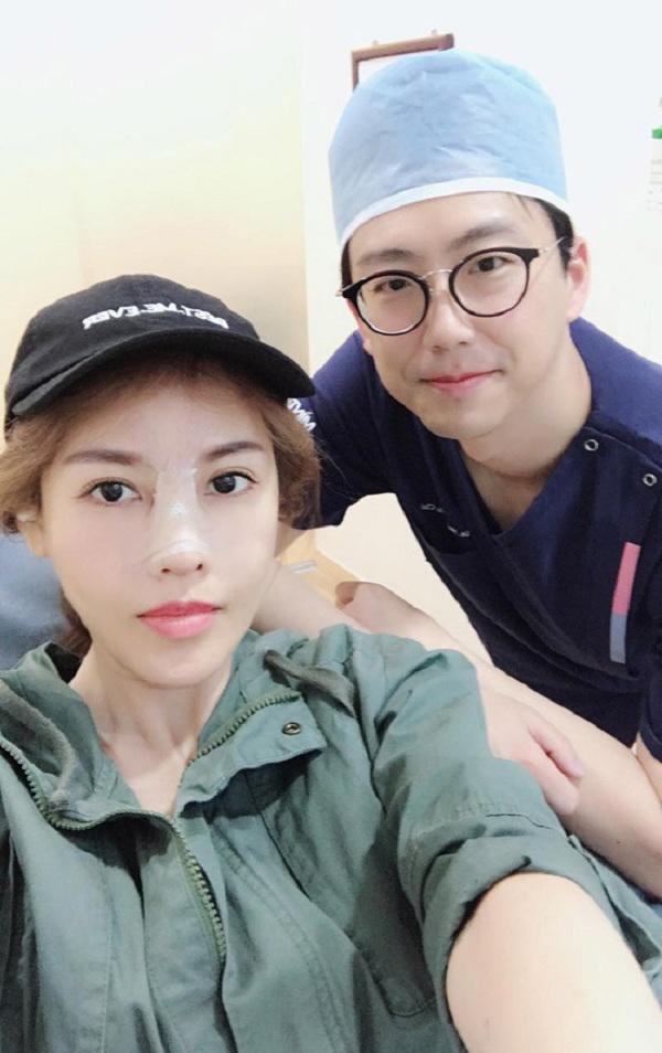 dien mao que van sau 6 lan phau thuat tham my gio ra sao? - 4