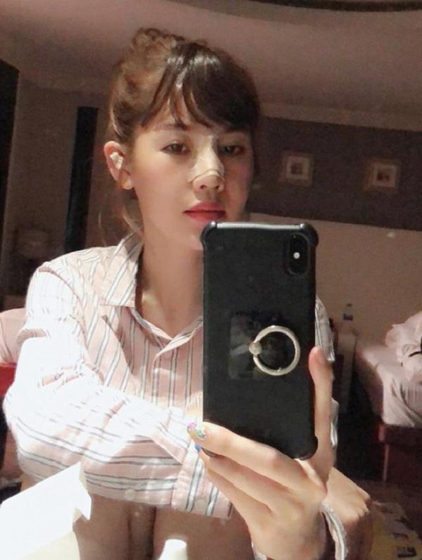 dien mao que van sau 6 lan phau thuat tham my gio ra sao? - 1