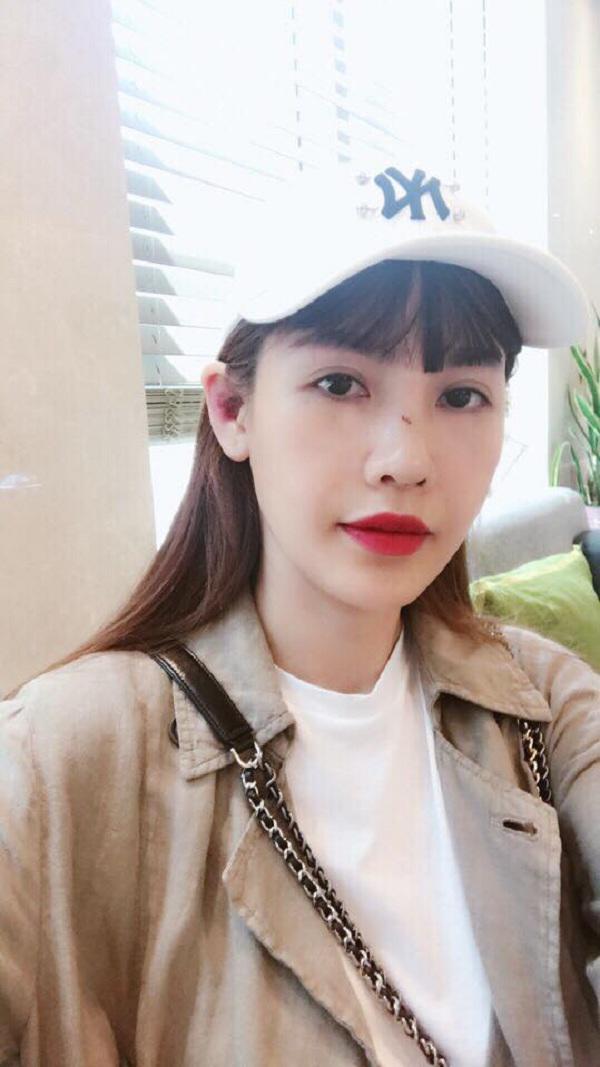 dien mao que van sau 6 lan phau thuat tham my gio ra sao? - 5