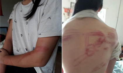 Hà Nội: Bố đẻ khóa trái cửa, dùng dây lưng bạo hành 2 con ứa máu suốt thời gian dài