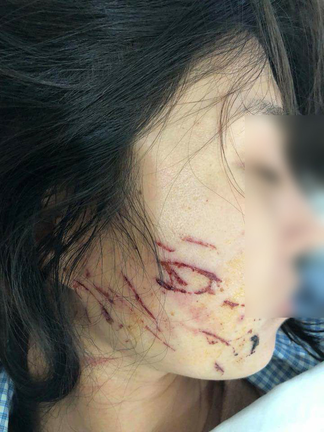 Vụ người phụ nữ bị lột đồ, đổ nước mắm ở Thanh Hóa: Báo cáo Bộ Công an về hành vi Làm nhục người khác Vụ người phụ nữ bị lột đồ, đổ nước mắm ở Thanh Hóa: Báo cáo Bộ Công an về hành vi Làm nhục người khác