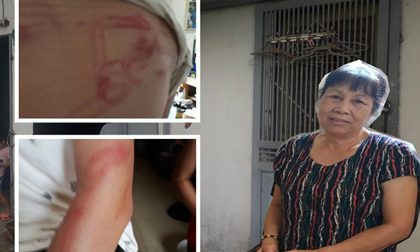 Vụ bố dùng tuýp sắt đánh con 'như kẻ thù': Người mẹ lên tiếng