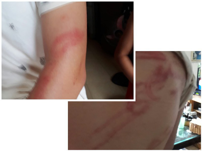 Vụ bố dùng tuýp sắt đánh con như kẻ thù: Người mẹ lên tiếng Vụ bố dùng tuýp sắt đánh con như kẻ thù: Người mẹ lên tiếng
