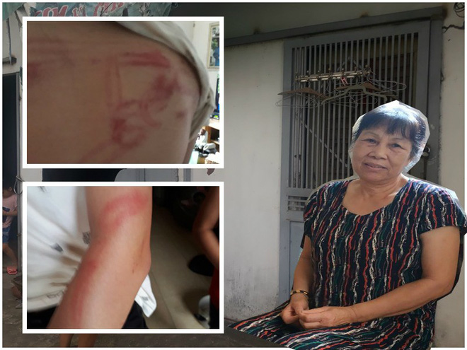 Vụ bố dùng tuýp sắt đánh con như kẻ thù: Người mẹ lên tiếng Vụ bố dùng tuýp sắt đánh con như kẻ thù: Người mẹ lên tiếng