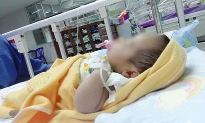 Bé 20 ngày tuổi bị thối ruột vì quan điểm chăm cháu sai lầm của người bà