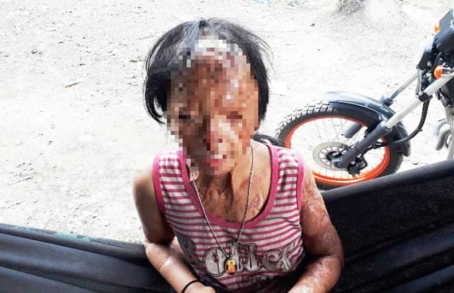 Nghẹn lòng ước mơ của bé gái bị tình địch của mẹ tạt a-xít mù hai mắt - 1